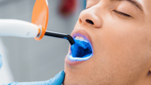 African American getting teeth whitening service